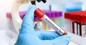 Azərbaycanın ilk autoimmun laboratoriyası hardadır?