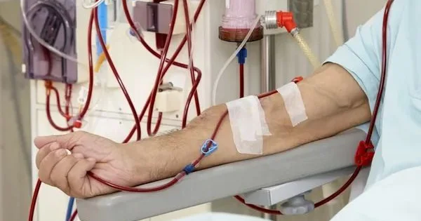 Yeni hemodializ şöbələri yaradılacaq