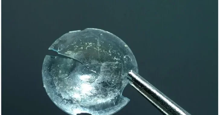 Носителей контактных линз предупредили об опасной болезни