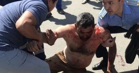 Tanışına boşqabla xəsarət yetirdi