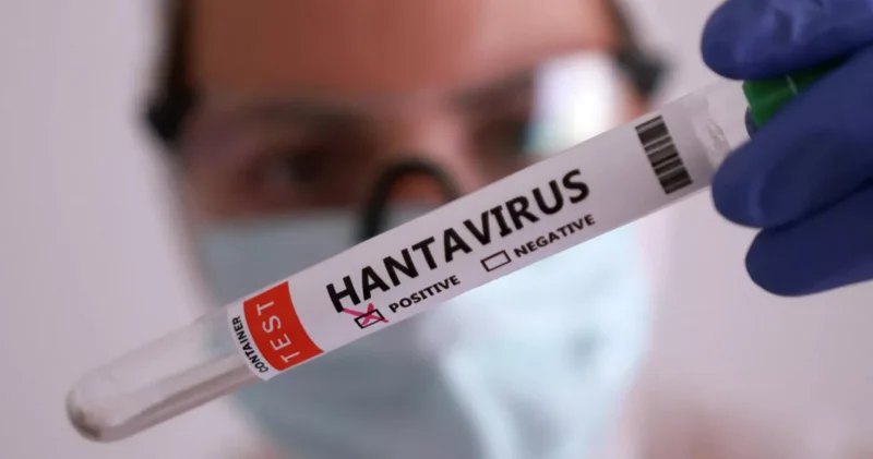 Təşvişə qapılmadan sadə gigiyena qaydalarına əməl etmək lazımdır Həkim hantavirusla bağlı iddialara aydınlıq gətirdi
