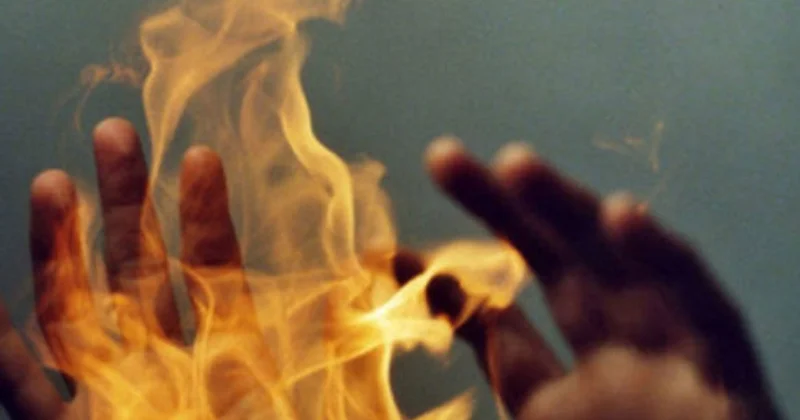 34 yaşlı ruhi xəstə özünü yandırdı