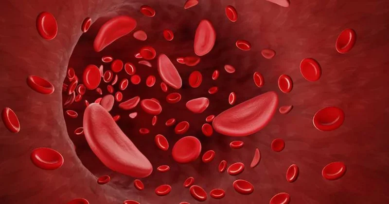 Xolesterinin səbəb ola biləcəyi xəstəliklər açıqlandı