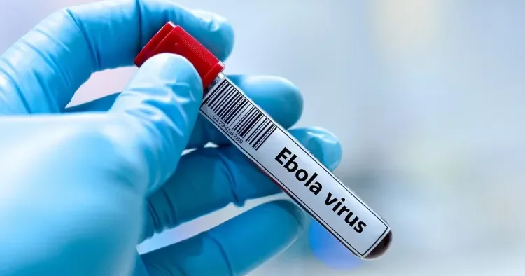 İsraildə Ebola təşvişi: Bir nəfər nəzarət altına alındı