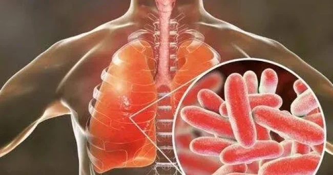 Yeni epidemiya yayılır: İlk ölüm xəbərləri gəldi