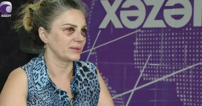 Keçmiş iş yoldaşı tərəfindən döyülən qadın DANIŞDI VİDEO