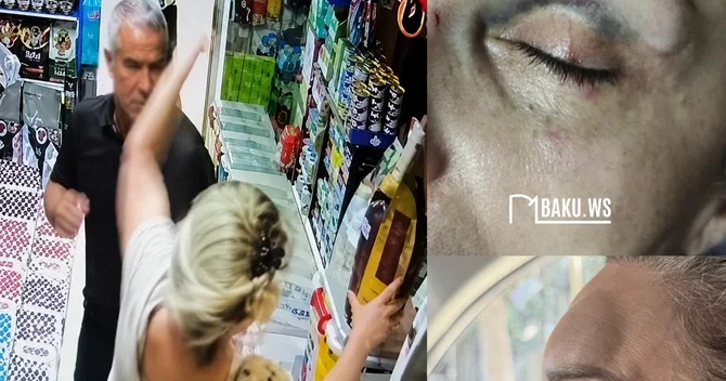Bakıda mağazaya girib qadını yumruqlayan kişi HƏBS OLUNUB