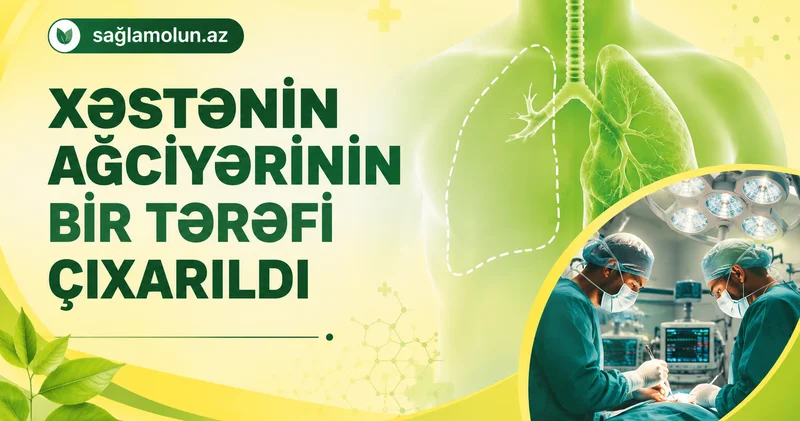 Ağciyərin bir hissəsi ilə yaşayır