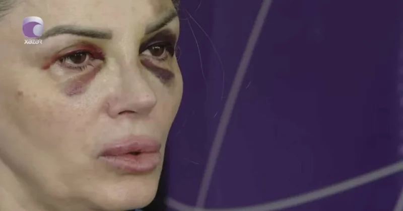 Bakıda mağazada döyülən qadın danışdı: “Demişdi ki, səni doğrayacağam” VİDEO