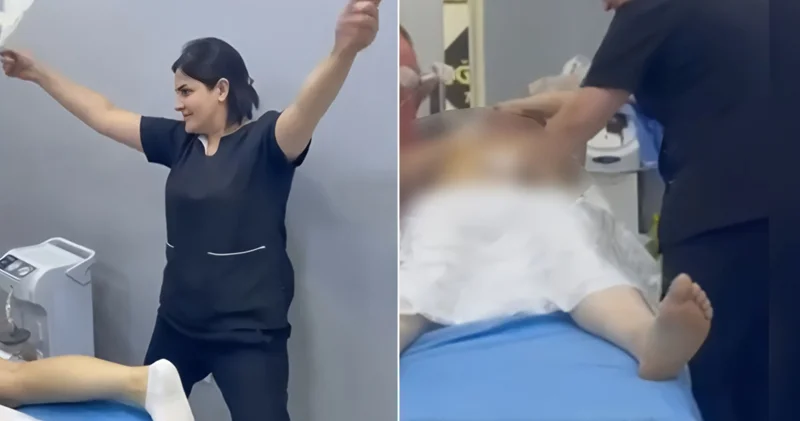 Saç ustası liposaksiya əməliyyatını necə edir?