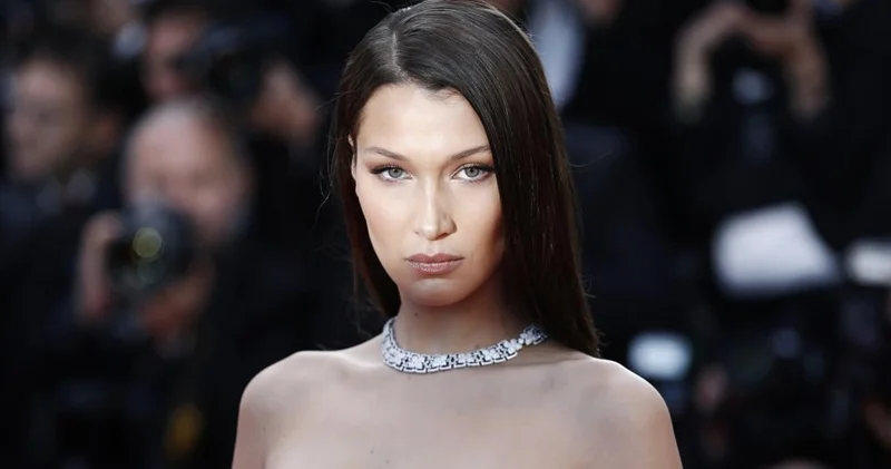 28 yaşlı modelin xəstəliyi kəskinləşdi, xəstəxanaya yerləşdirildi (FOTO)
