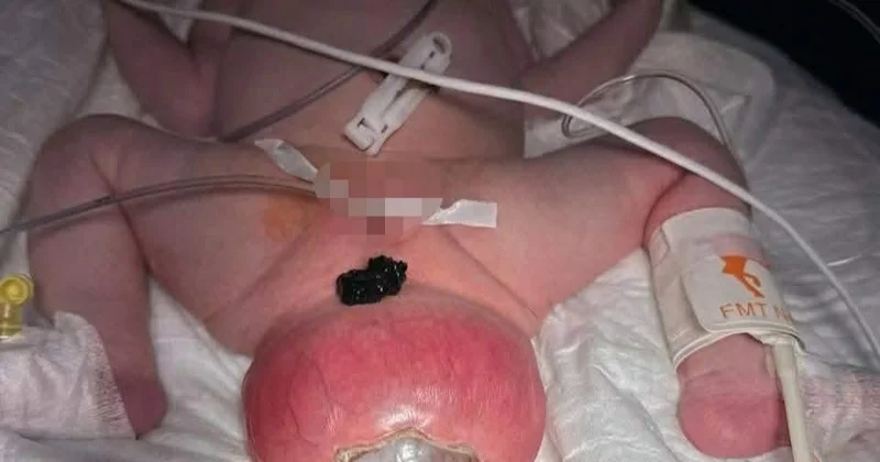 Büzdüm nahiyəsində şiş olan körpə əməliyyat edildi FOTO