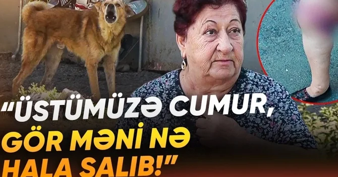 Əhali dəhşət içində: Sahibsiz itlər 75 yaşlı qadını dişləyib