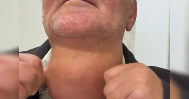 Pasiyentin zobu görənləri təəccübləndirdi VİDEO