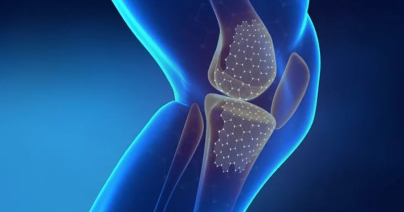 Mütəxəssis: Osteoporoz xəstəliyi qadınlarda daha çox müşahidə olunur
