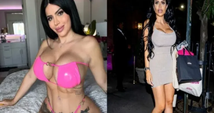 100 min xərcləyib plastik əməliyyatdan imtina etdi: təbii gözəlliyi üçün