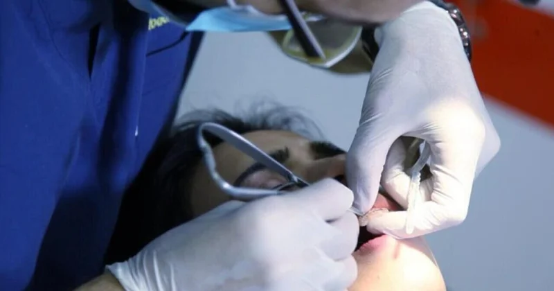 TƏBİB stomatoloqlara xəbərdarlıq etdi Tədbir görüləcək