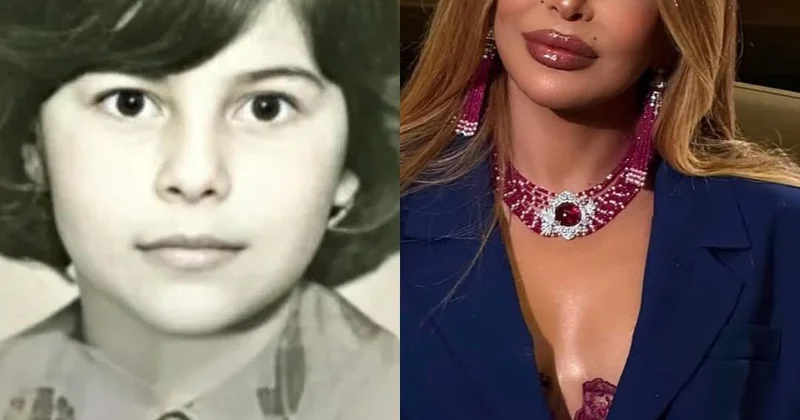 Aygün Kazımovanın illər ərzində dəyişimi FOTO