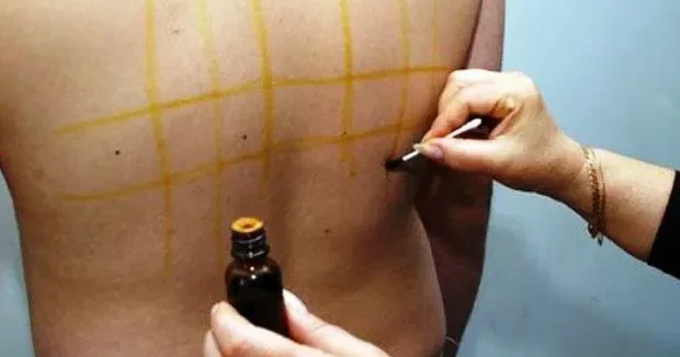 Dərinin sağlamlığı üçün beş əsas tərkib hansıdır?