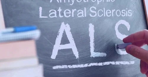 “Amiotrofik Lateral Sklerozun müalicəsində yeni ümid işığı“ İsrail alimlərindən inanılmaz kəşf