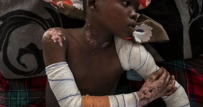 Новый полигон: кровь в обмен на золото наша аналитика