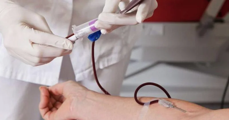 Xarici donorlardan sümük iliyi köçürülməsinə başlanılır