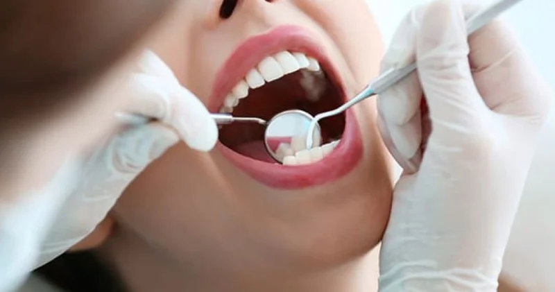 Bölgələrdə stomatoloq ştatı ləğv olunur? RƏSMİ