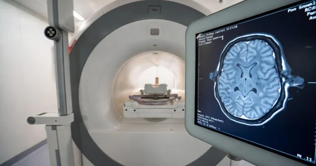 Gündəlik sadə vərdişlər beyninizi səkkiz il gənc saxlaya bilər...