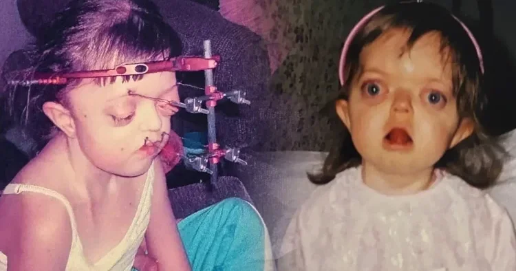 Nadir genetik xəstəliklə doğuldu, hər kəsi təəccübləndirdi