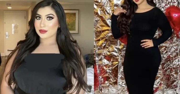 Ac qalmadan 23 kilo verdi: “Sadəcə hər yeməyin yanında bunu yeyirdim” FOTO