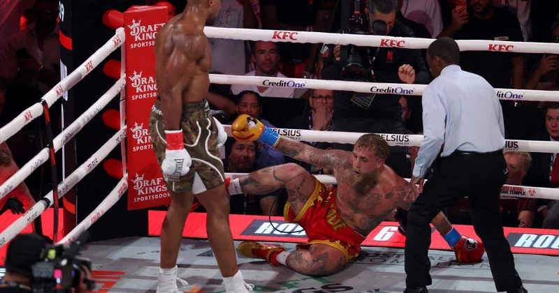 Ceyk Pol sınmış çənəsinin şəklini paylaşıb və yenə döyüşmək istədiyini bildirib FOTO