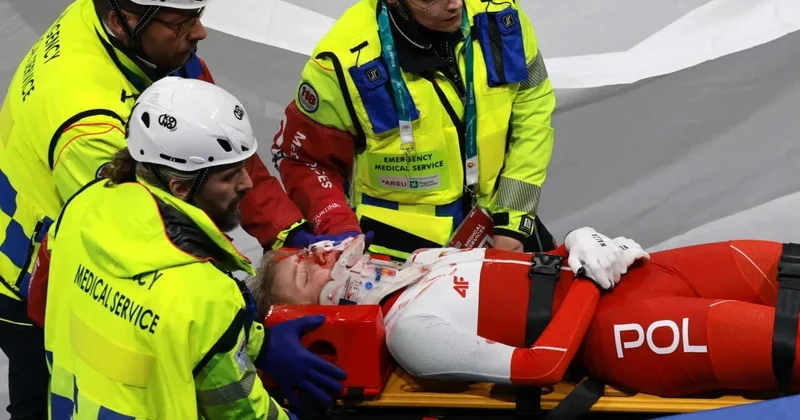 Польская спортсменка получила травму лица на Олимпиаде ВИДЕО