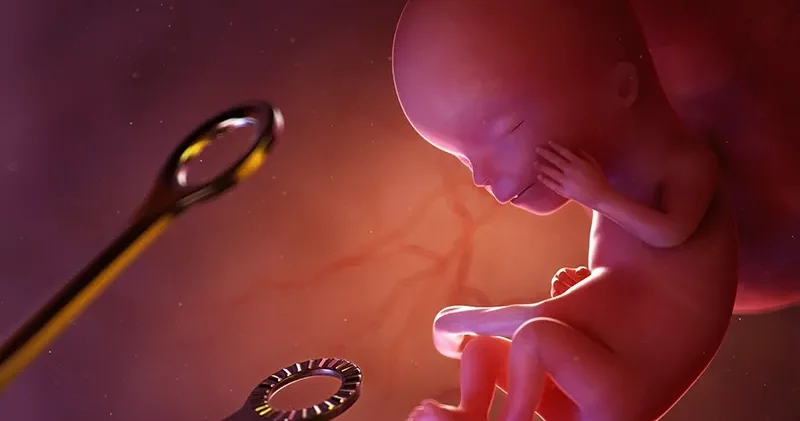 Azərbaycanda aborlatın sayı 5 minə yaxın ARTIB
