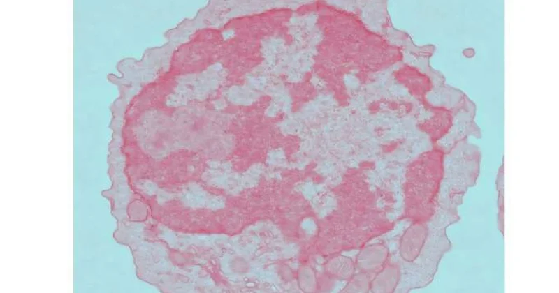 Yeni tədqiqat metabolik mexanizmanı aydınlaşdırır