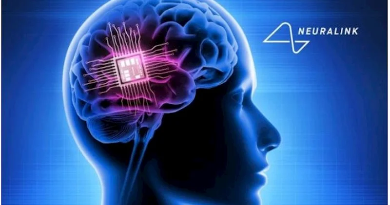 “Neuralink” insan beyni üçün riyazi prosessor hazırlayacaq