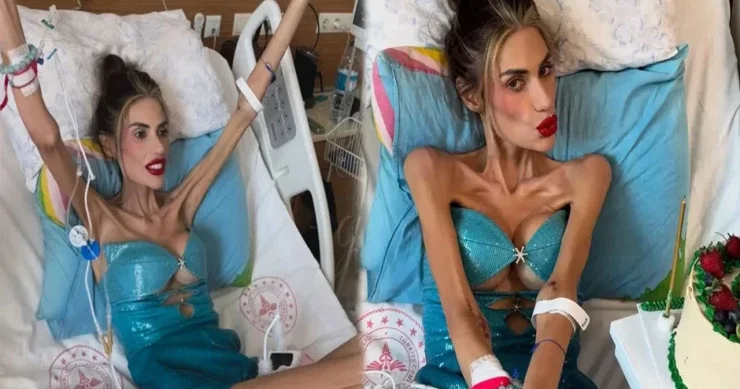 Arıqlayıb 25 kiloya düşən Nihal Candan öldü