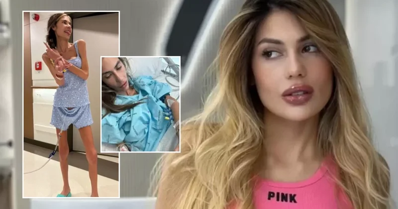 Türkiyəli fenomen 23 kiloqram çəkiyə düşərək öldü