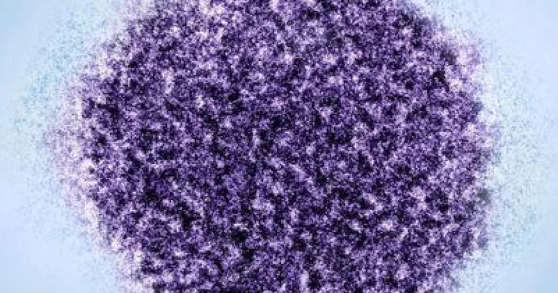 Hepatit C virusunun psixiatrik pozğunluqlarla əlaqəsi aşkarlanıb TƏDQİQAT