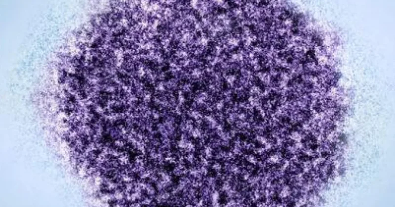 Hepatit C virusunun psixiatrik pozğunluqlarla əlaqəsi aşkarlanıb TƏDQİQAT