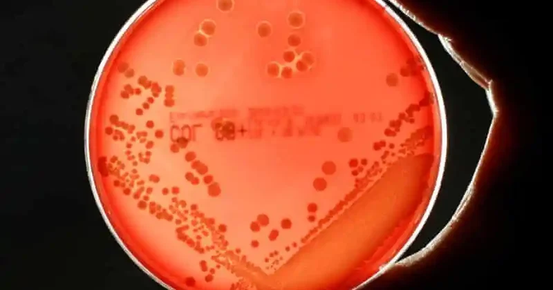 Antibiotiklərin təsiri azalır
