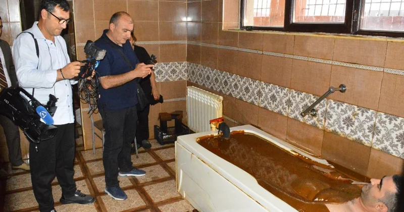 Naftalanda onların bərpa müalicəsi uğurla həyata keçirilir Fotolar