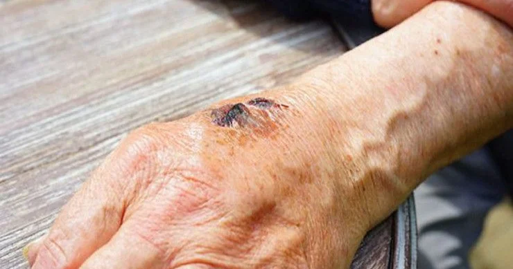 Baş verən qarayara hadisəsi ilə bağlı məlumat yaydı KONKRET