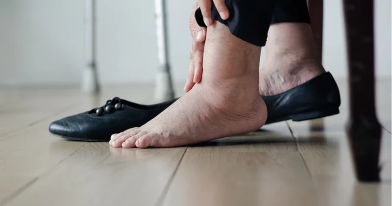 Keçməyən ayaq şişkinliyi ürək çatışmazlığının xəbərçisidir