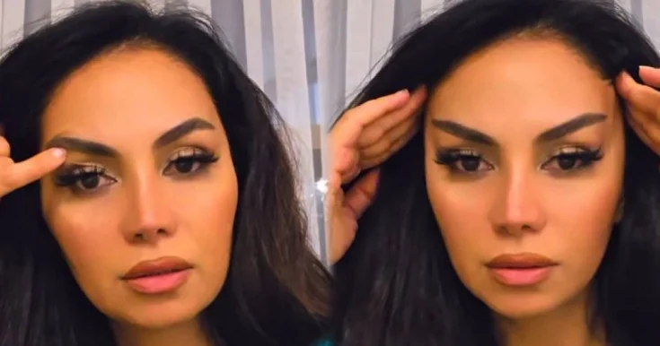 Sevda Sanəliyeva plastik əməliyyat etdirənləri tənqid edib