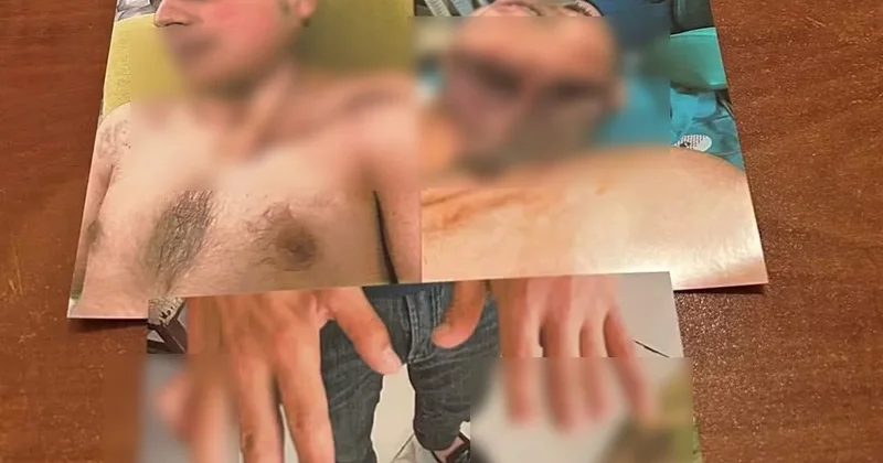 Qaziyə əlillik təyin edilməyib? Rəsmi açıqlama