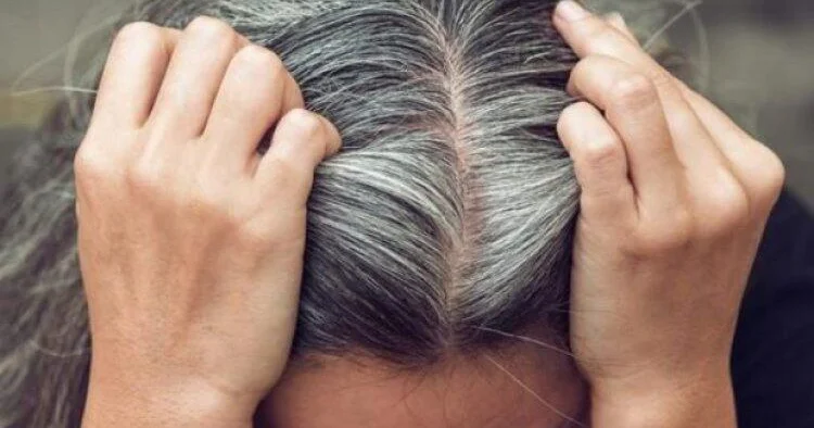 Saçın vaxtından əvvəl ağarmasının başlıca SƏBƏBLƏRİ