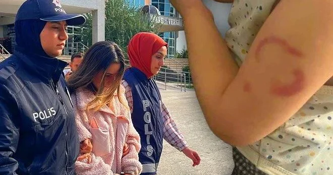 Bağçada dəhşət: 3 yaşlı uşağı dişləyən baxıcı həbs olundu