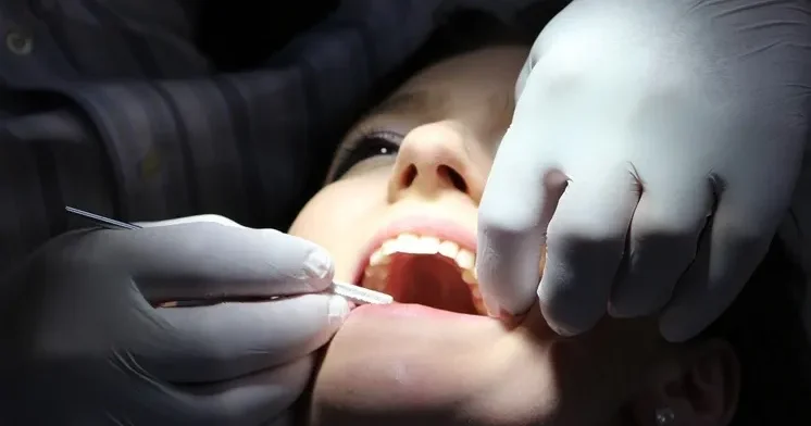 “Ağıl dişi”ni çıxartdırmaq hansı təhlükəli nəticələrə səbəb ola bilər?