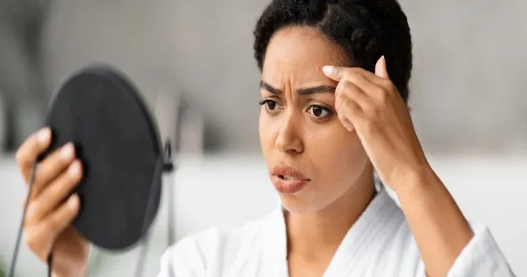 Həyatınızı məhv edən az bilinən dəri xəstəliyi