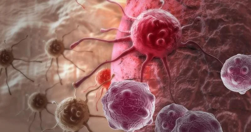 Xərçəng görün necə gizlənir